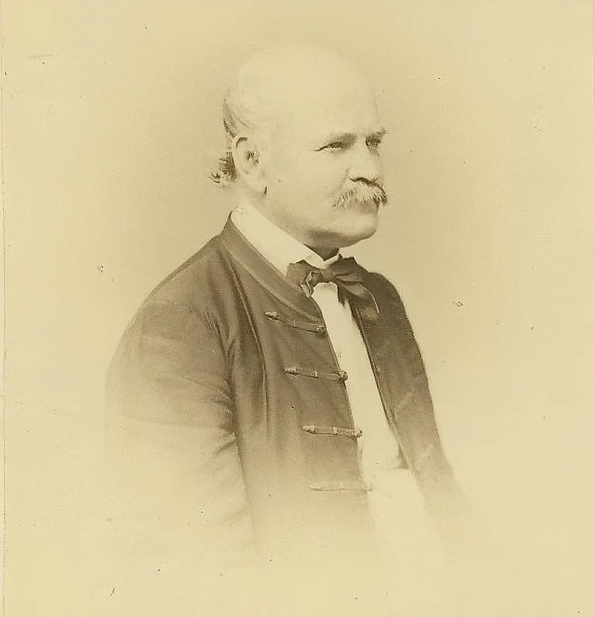 Photograph of Ignaz Semmelweis in 1860 by "Borsos és Doctor" (cropped version); this image inspired the famous engraving of Semmelweis by Jenő Doby.